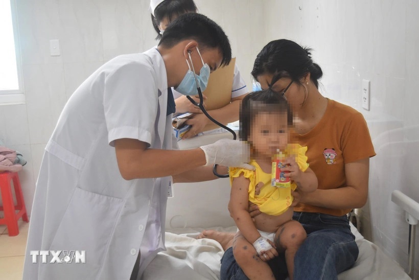 Enterovirus 71 là tác nhân gây bệnh tay chân miệng có độc lực cao, cần sẵn sàng phương án điều trị và kiểm soát lây nhiễm bệnh tay chân miệng.
